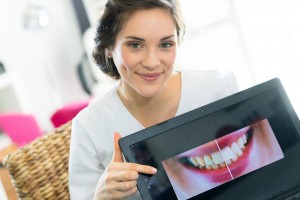 dental worker showing before and after teeth bleaching